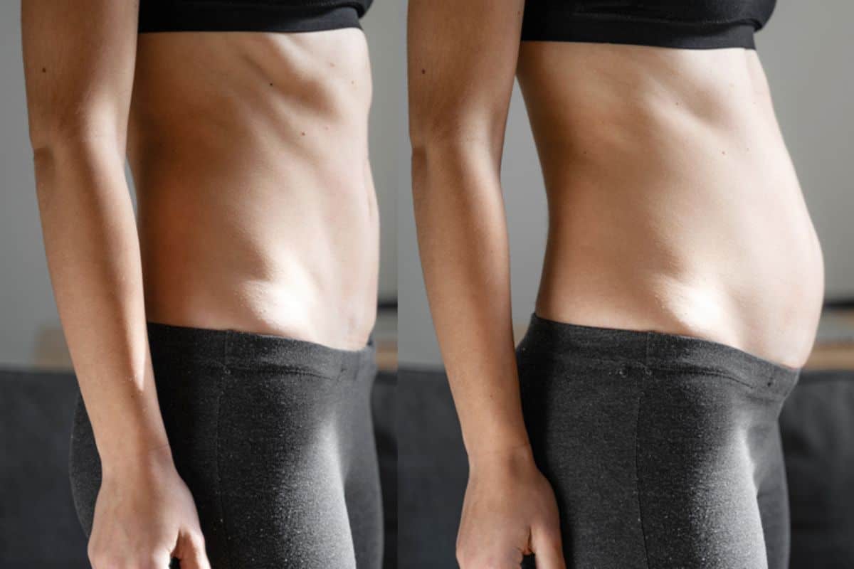 How long does diastasis recti take to improve Swindon?