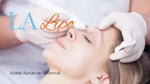 Woman receiving Actinic Keratosis Removal Treatment Swindon