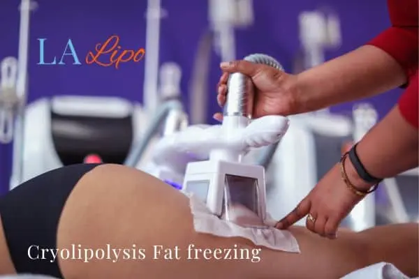 women getting fat freezing Swindon