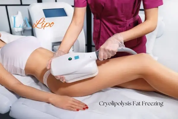 Woman receiving coolsculpting Swindon treatment on her thighs