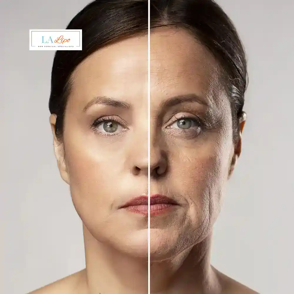 How Can You Tell If Non-Surgical Skin Tightening Is Right for You Swindon?