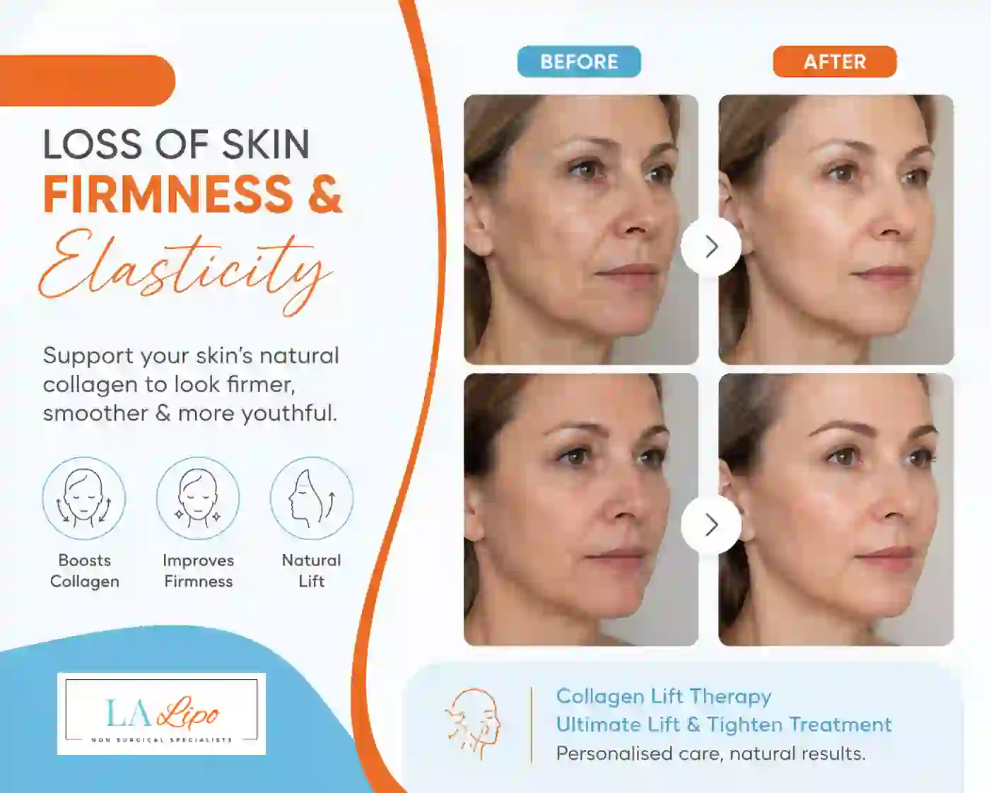 Sign #7: Loss of Skin Firmness and Elasticity Swindon