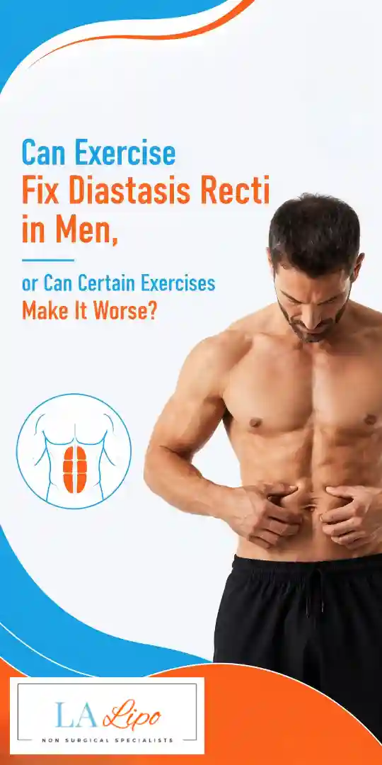 Can Exercise Fix Diastasis Recti in Men, or Can Certain Exercises Make It Worse Swindon?